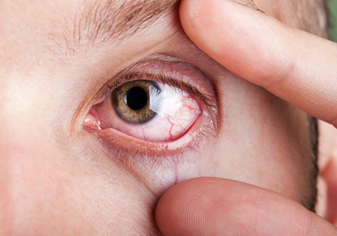 Salute. ‘Vediamoci Chiaro’, a Milano si fa prevenzione contro le maculopatie