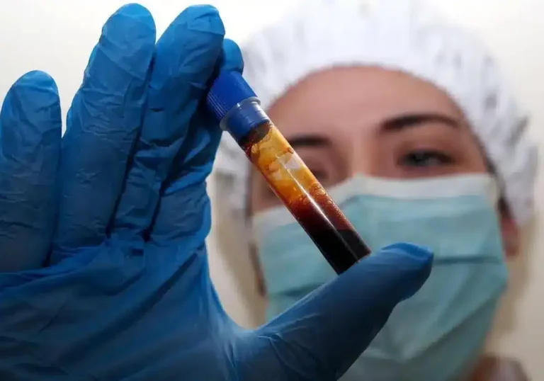 Hantavirus: altra turista inglese in quarantena all’Ospedale Sacco: è negativa