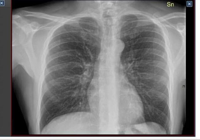 Asst Ovest Milanese: consultazione online delle immagini diagnostiche di Radiologia
