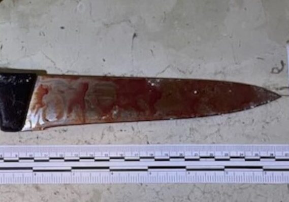 Novara: litiga col vicino e lo accoltella, arrestato per tentato omicidio